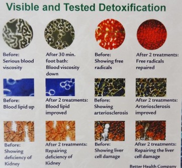 Blood Detoxification