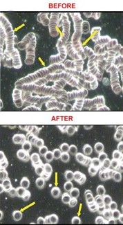 Before and After Blood Cleaning